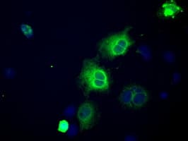 NPR3 Antibody (clone OTI2B12, Carrier-free)
