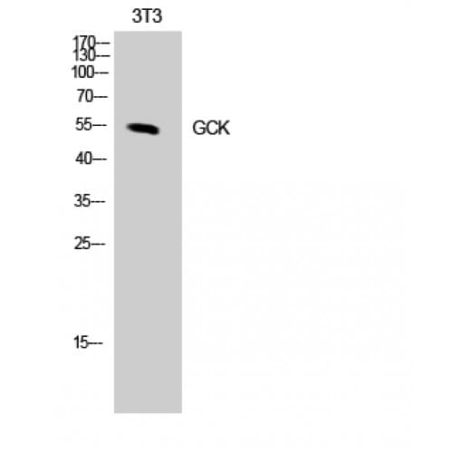 GCK / Glucokinase Antibody (N-Terminal)