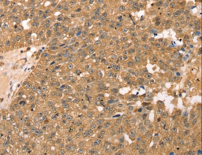 RPLP2 Antibody