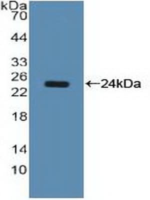 NCL / Nucleolin Antibody (aa388-569, Biotin)