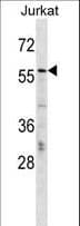 CBFA2T2 / MTGR1 Antibody (aa1-29)
