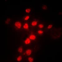 MLH1 Antibody (Internal)