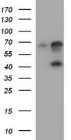 SERPINB3 Antibody (clone OTI1G9)