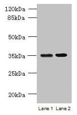 Polyclonal Rabbit anti-Human CCDC108 Antibody (Coiled-coil domain, IHC, WB)