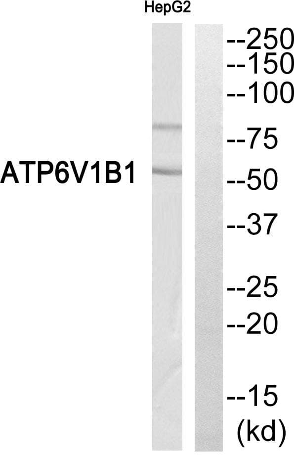 ATP6V1B1 Antibody