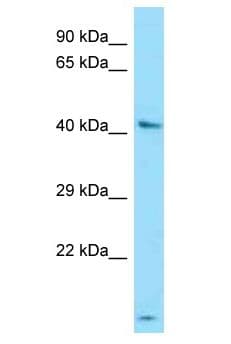 UGT3A1 Antibody (aa45-94)