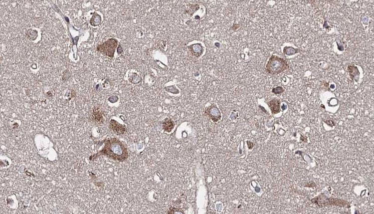 PSRC1 / DDA3 Antibody