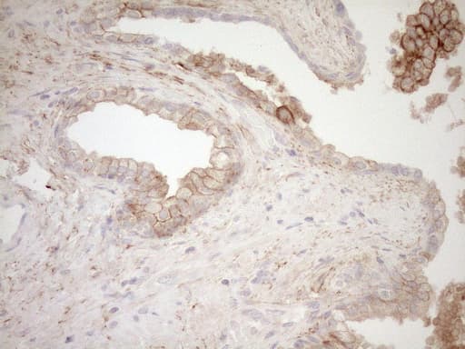 CAPN5 / Calpain 5 Antibody (aa274-578, clone OTI7D2, Carrier-free)