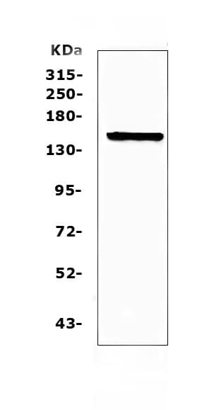 Polyclonal Rabbit anti-Mouse CD135 / FLT3 Antibody (IHC, WB)