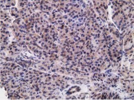 RBBP9 Antibody (clone OTI4G9)