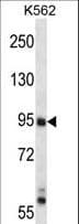 IHC-plus™ MAP3K10 / MLK2 Antibody (aa110-138)