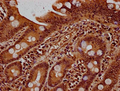 Polyclonal Rabbit anti-Human HIST1H1E Antibody (IHC)