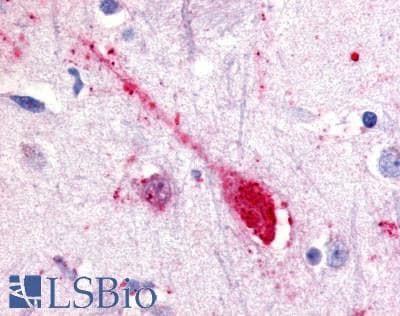 IHC-plus™ SREB / GPR85 Antibody (Extracellular Domain)