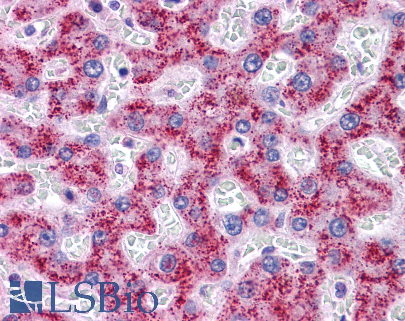 IHC-plus™ Polyclonal Rabbit anti-Human SYPL1 Antibody (IHC, WB)