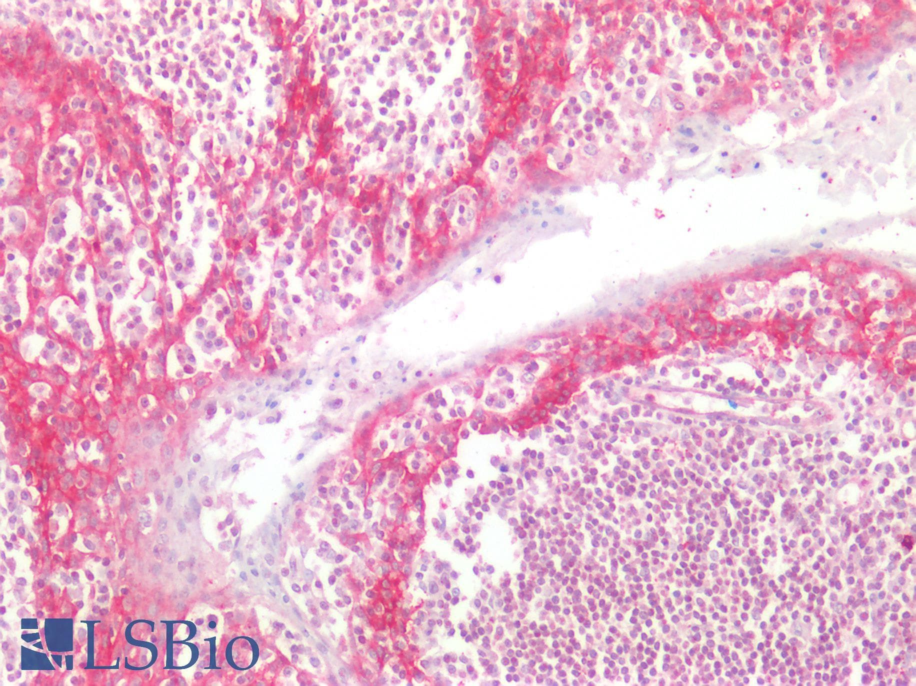 PathPlus™ NDRG1 Antibody (aa382-394)