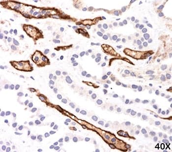 Complement C4d Antibody (clone C4D204)