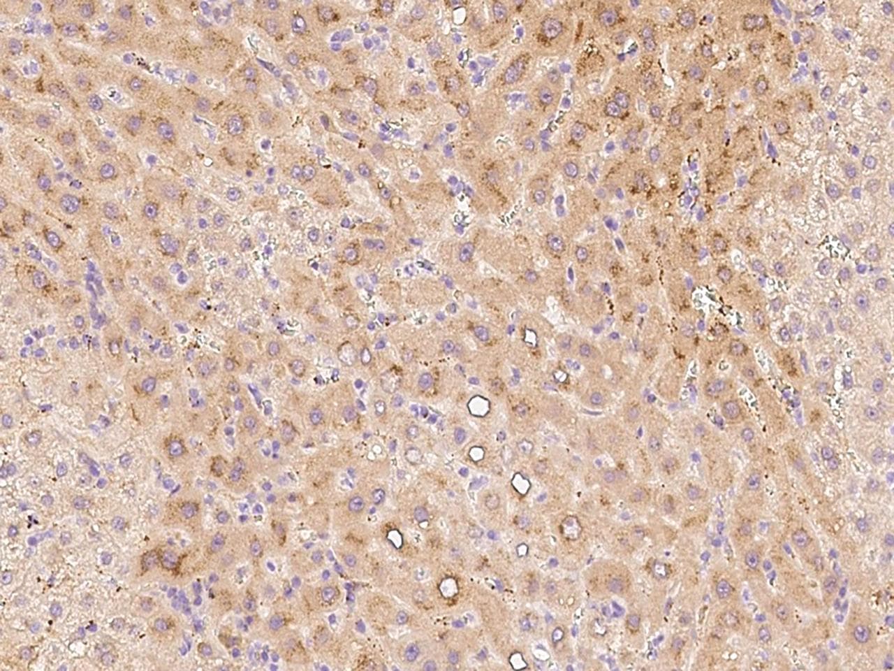 Chordin Antibody (Preservative Free)