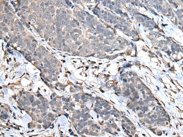 Polyclonal Rabbit anti-Human UPK3A / UPK3 / Uroplakin III Antibody (IHC)