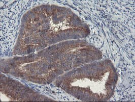 VBP1 Antibody (clone OTI1A5)