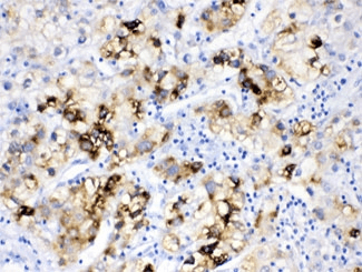 FACL2 / ACSL1 Antibody