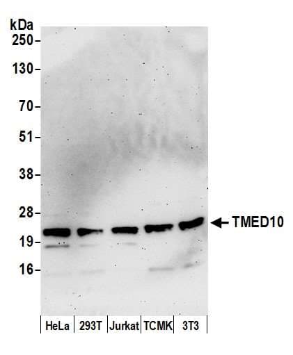 TMED10 / TMP21 Antibody (aa169-219)