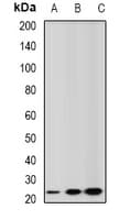 GSTA2 Antibody