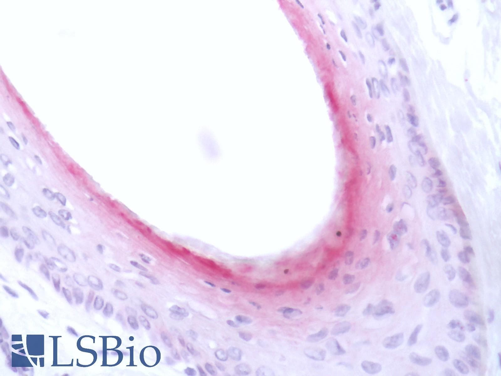 IHC-plus™ KRT84 / Keratin 84 / KRTHB4 Antibody (aa326-365)