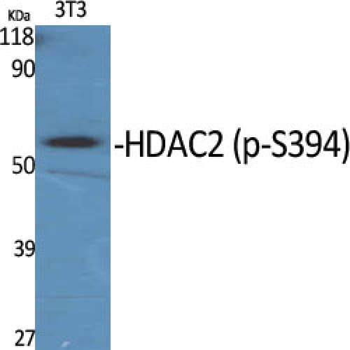 Polyclonal Rabbit anti-Human HDAC2 Antibody (330-410 aa, WB)