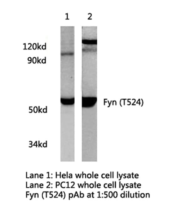 SYN / FYN Antibody (Thr524)