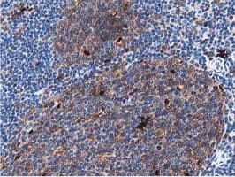 Monoclonal Mouse anti-Human SQSTM1 Antibody (clone OTI4E2, IHC, IF, WB)