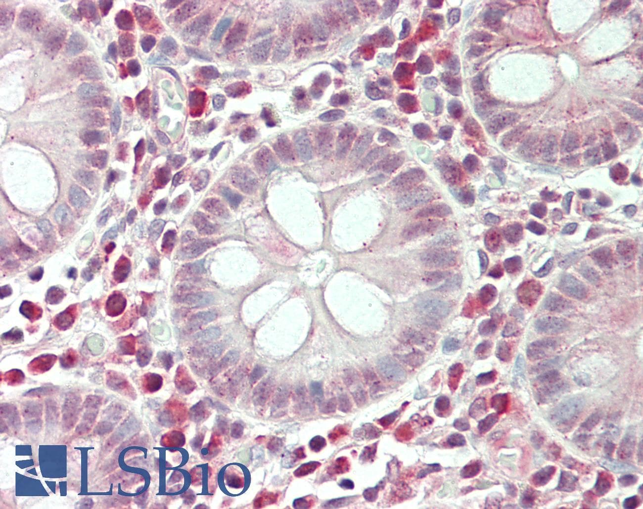 IHC-plus™ Polyclonal Rabbit anti-Human SPON2 / MINDIN Antibody (aa55-104, IHC, WB)
