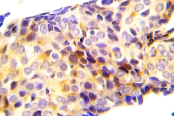 Polyclonal Rabbit anti-Human CTNNB1 / Beta Catenin Antibody (phospho-Thr41, IHC)