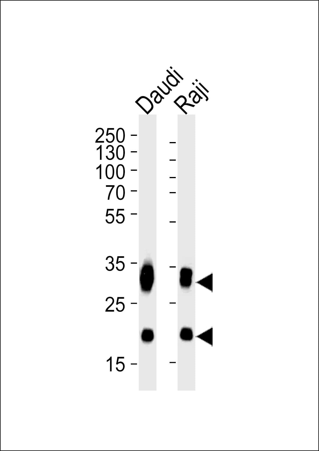 CD74 / CLIP Antibody (aa1-232, clone 1267CT820.116.140.154)