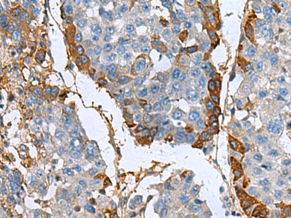 Polyclonal Rabbit anti-Human TGFBI Antibody (IHC, WB)