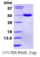Human GPD1L Protein (Recombinant His)