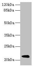 Polyclonal Rabbit anti-Mouse Mup8 + Mup11 Antibody (WB)