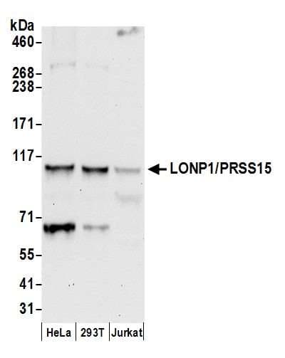 Polyclonal Rabbit anti-Human LONP1 / LON Antibody (aa909-959, WB)