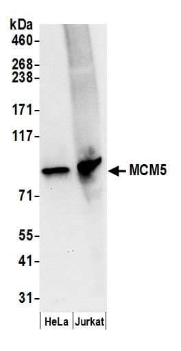 Polyclonal Rabbit anti-Human MCM5 Antibody (aa1-50, IHC, WB)