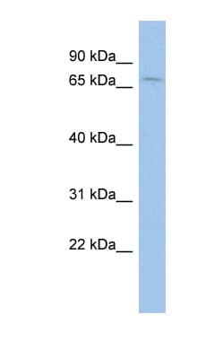 ASIC1 / ACCN2 Antibody (N-Terminus)