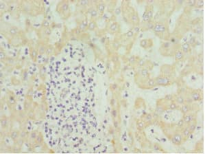 HMGCL Antibody