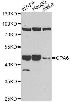 CPA6 / Carboxypeptidase A6 Antibody