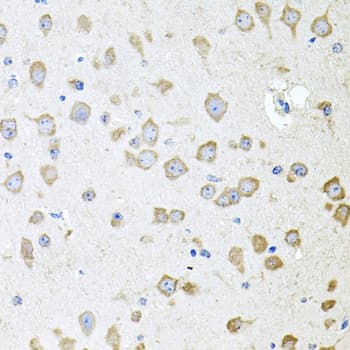 Polyclonal Rabbit anti-Human AKAP5 / AKAP79 Antibody (IHC, WB)
