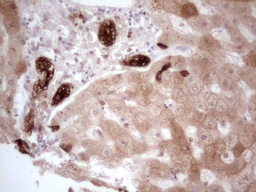 PHGDH Antibody (clone OTI5C4)