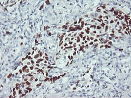 Monoclonal Mouse anti-Human TP53 / p53 Antibody (clone OTI1E1, IHC, WB)