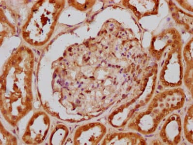 HIST1H2BN Antibody