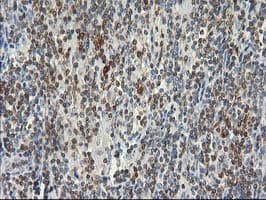 Monoclonal Mouse anti-Human STAT5A Antibody (clone OTI9A5, IHC, IF, WB)