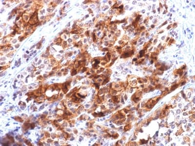 GPC3 / Glypican 3 Antibody (clone rGPC3/863, Azide-free, Carrier-free)