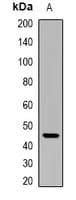 PathPlus™ IKZF1 / IKAROS Antibody
