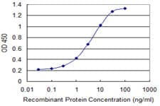CTNNB1 / Beta Catenin Antibody (clone 1C9)