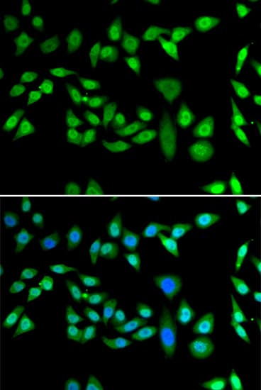 Polyclonal Rabbit anti-Human DNAJB6 Antibody (IHC, IF, WB)